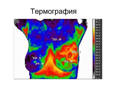 кафедра госпитальной хирургии ЗАБОЛЕВАНИЯ МОЛОЧНОЙ ЖЕЛЕЗЫ ассистент кафедры