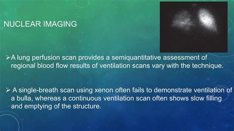 BULLOUS DISEASENOF THE LUNG.pptx high yield topic | PPTX