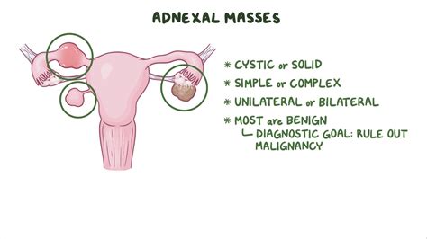 Approach to adnexal masses: Clinical sciences - Osmosis Video Library