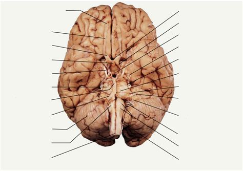 Brain 的图像结果