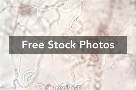 Mold Under Microscope 的图像结果