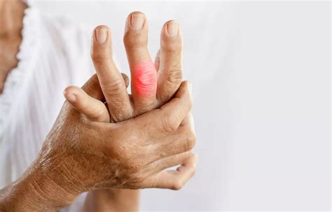 Lipofilling procedure improves pain and function in finger osteoarthritis