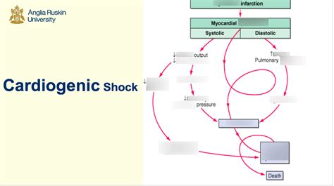 Image result for Cardiogenic Shock Algorithm