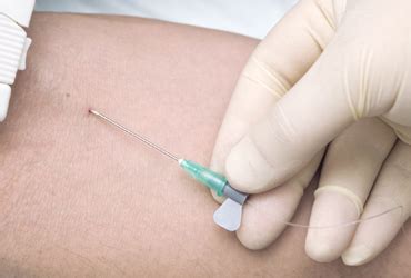 Image result for Tip Culture Methode Modification