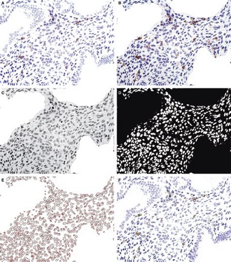 Image result for Computer Assistant Image Analysis ImageJ