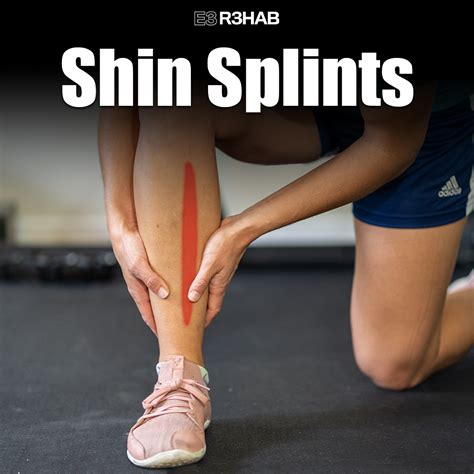 Shin Splints - E3 Rehab