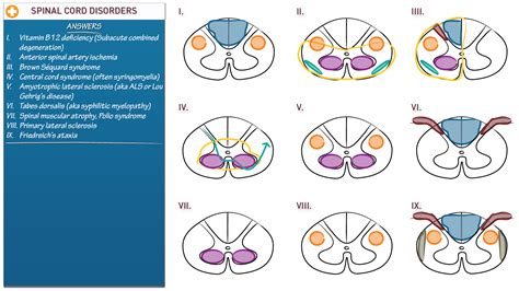 Neuroanatomy: Spinal Cord Disorders | ditki medical & biological sciences