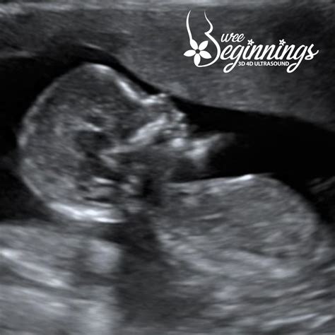 30 Weeks Ultrasound Boy