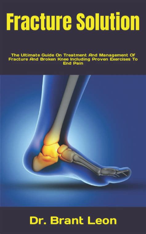 Buy Fracture Solution: The Ultimate Guide On And Management Of Fracture ...