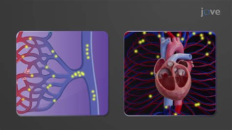 Video: Venous Return