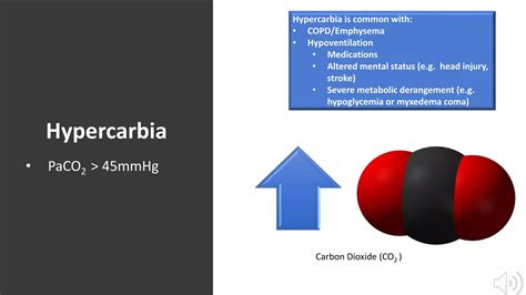 Indications for Intubation and Mechanical Ventilation | PPTX