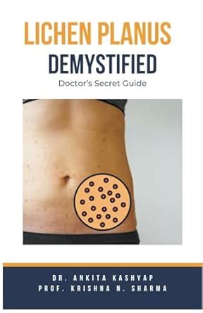 Buy Lichen Planus Demystified Doctors Secret Guide Book Online at Low ...