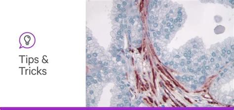Image result for Poor IHC Staining
