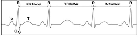 Image result for R-R Interval Calculation for ECG Code in Python