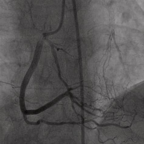 T-trendz Issue 2 / 2021 - Siemens Healthineers India