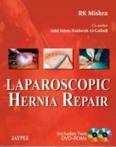 Laparoscopic Hernia Repair: Buy Laparoscopic Hernia Repair by Mishra RK ...