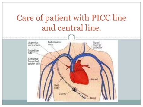 Care of patient with PICC line and central.pptx