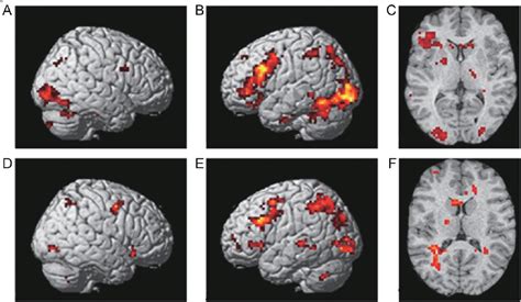 Encoding Memory 的图像结果