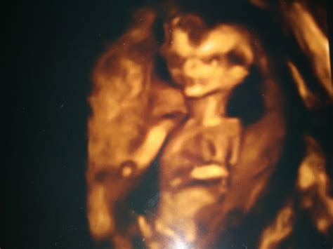 Image result for Alien Baby Ultrasound Scene