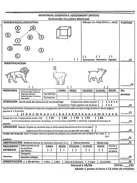 Moca Test Online 的图像结果