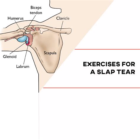 Exercises for a SLAP Tear - [P]rehab