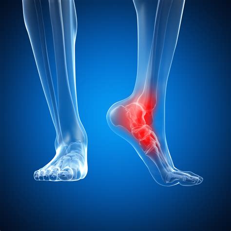 Ankle Pain: Symptoms, Causes and Treatment | STD.GOV Blog