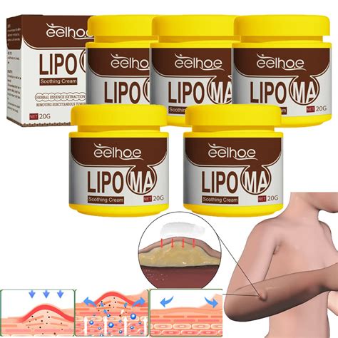 Herbal Lipoma Removal Cream - Instant Lump-free Philippines | Ubuy