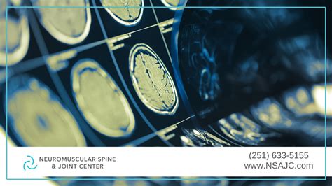 How to Spot a Concussion & What to Do | NSAJC