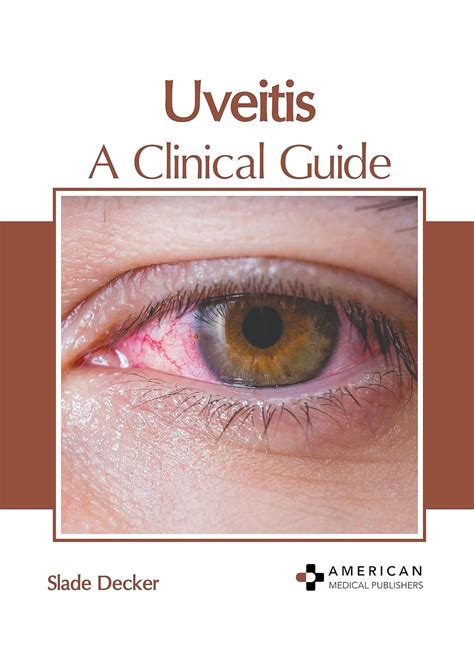 Buy Uveitis: A Clinical Guide Book Online at Low Prices in India ...
