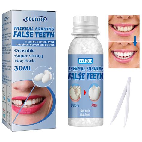 Jrehoor Moldable Tooth Repair Kit - 30ml, Temporary Teeth India | Ubuy