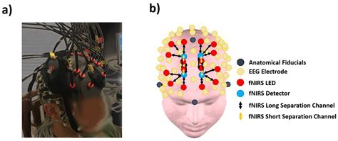 Working Memory Decline in Alzheimer’s Disease Is Detected by Complexity ...