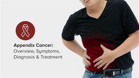 Image result for Appendix Cancer Symptoms