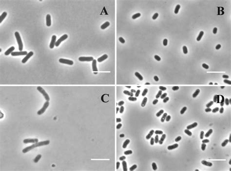 E. Coli Stationary Phase