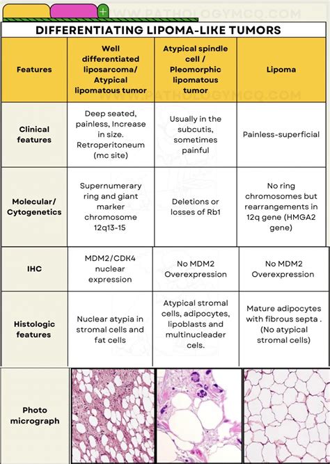 Lipoma Vs Liposarcoma