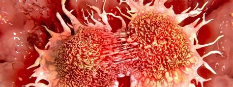 Image result for Cancer Detection Using Graph CNN