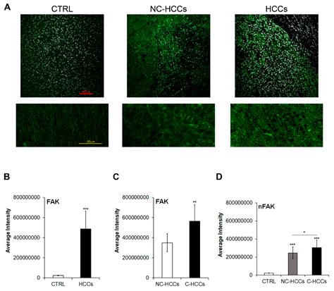 Focal Adhesion Kinase (FAK) Over-Expression and Prognostic Implication ...