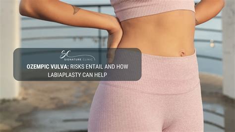 Ozempic Vulva: Side Effects & How Labiaplasty Can Help