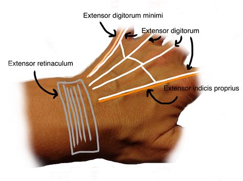 Extensor Tendon
