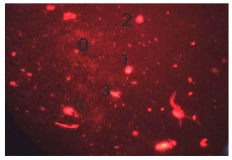 Sodium Alginate-Based MgO Nanoparticles Coupled Antibiotics as Safe and ...