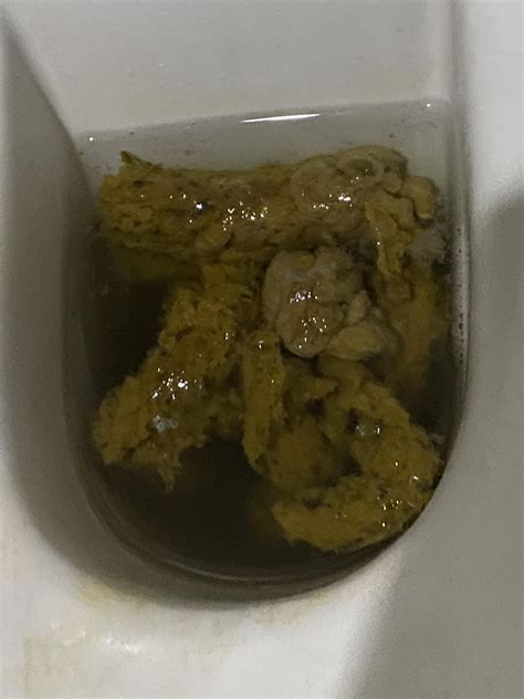 Flat poop : r/poop