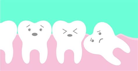Wisdom Teeth Function 的图像结果