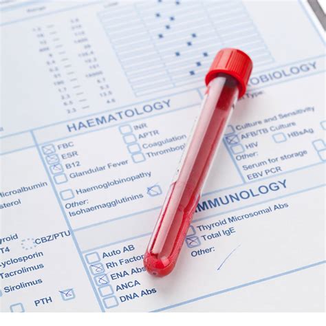 GGT - Gamma Glutamyl Transpeptidase Liver Enzyme – Test Smartly Labs