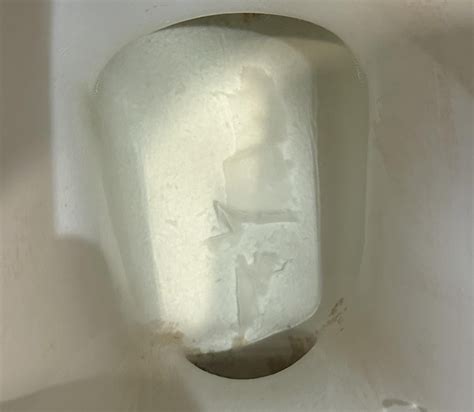 Tissue in urine? : r/medicalmedium