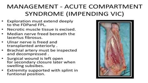 volkmann ischemic contracture orthopaedics.pptx