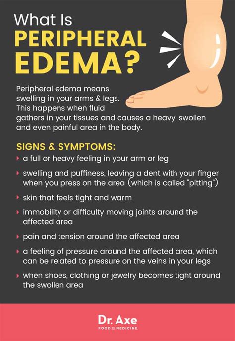Cure Edema 的图像结果