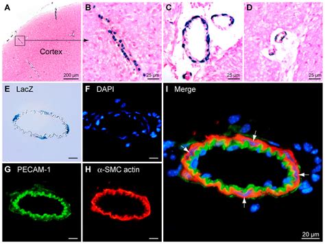 Image result for Alpha Complementation LacZ Assay