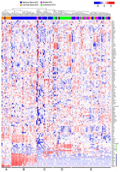 Dominant Gene Expression Profiles Define Adenoid Cystic Carcinoma (ACC ...