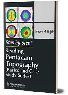 JaypeeDigital | Quick Review of Pentacam Main Maps