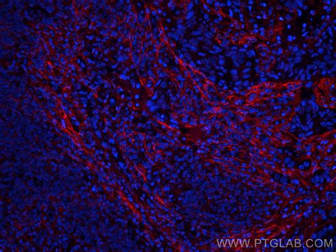 Collagen Type I antibody (CL594-67288) | Proteintech