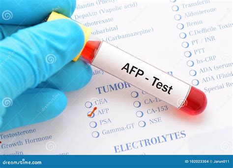 Image result for How AFP Test Done
